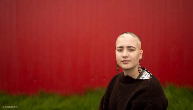 Sólvør, alopecia