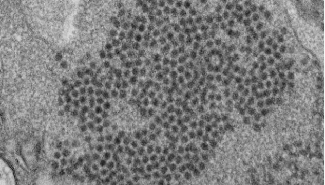 enterovirus entero virus D68